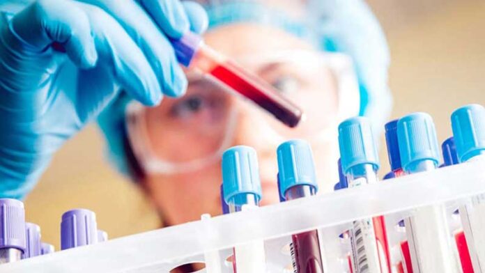 آزمایش خون جدید برای تشخیص سرطان